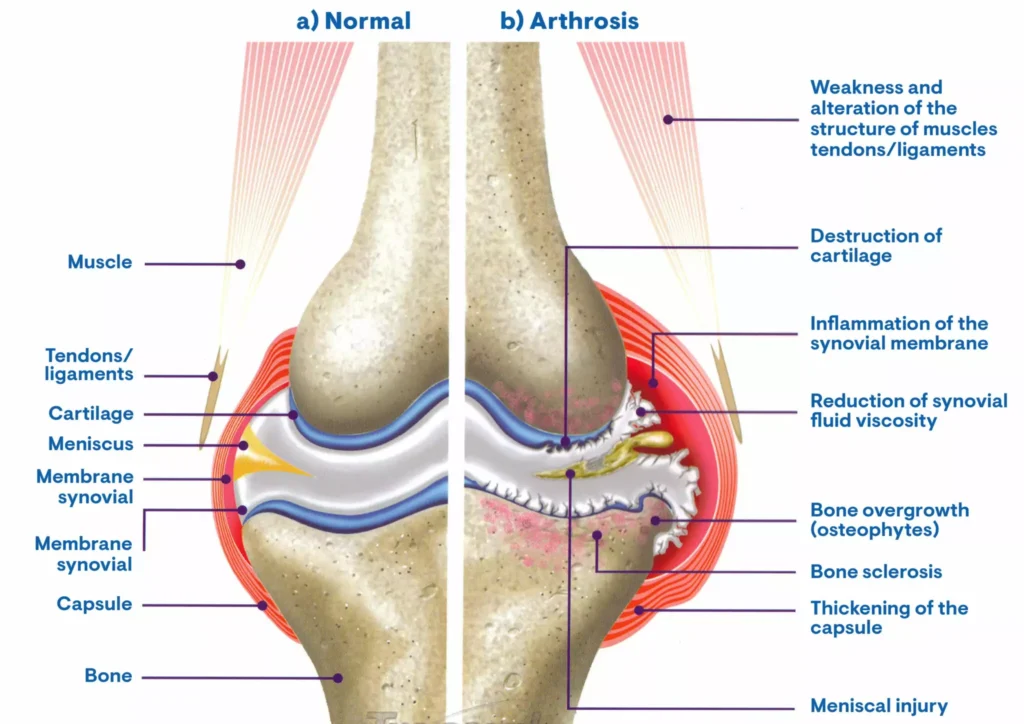 Condroprotector Hyaloral®: Máxima eficacia. 6